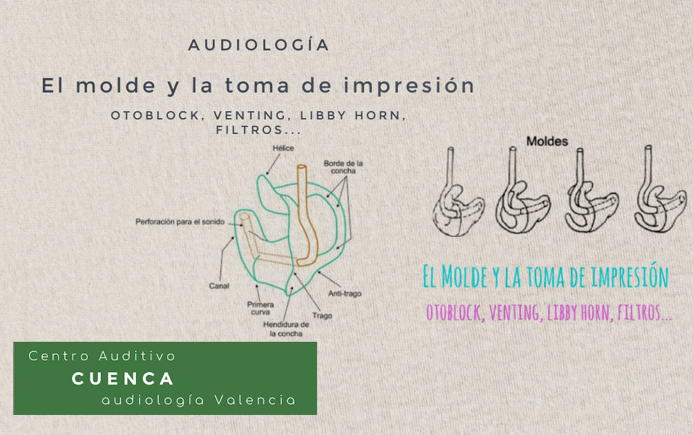 Ningún laboratorio propio o ajeno, puede hacer un buen molde de una mala impresión.