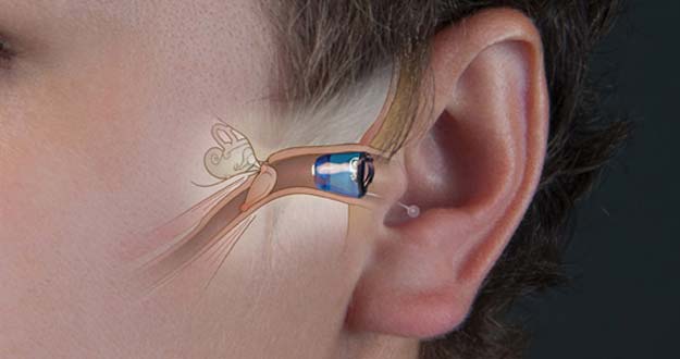 Los airpods me lastiman la oreja clearance