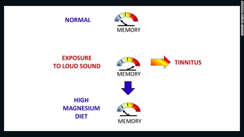 en el momento en que la pérdida temporal de la audición desaparece, el impulso de la señal se ha almacenado como una "memoria" en el núcleo coclear dorsal, una memoria que no se olvida fácilmente.