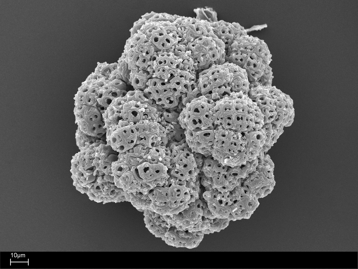 Separated colony of Botryococcus sp., sample S4 14-63; Holocene, Lake Pupuke, Auckland, New Zealand