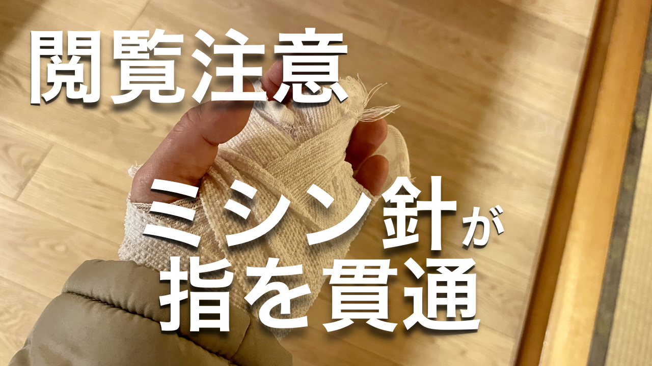 ミシン針が指を貫通 通院・手術記録