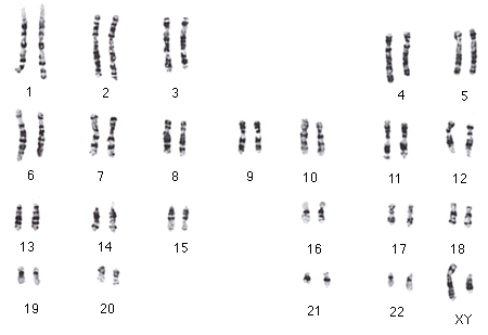 Karyogramm Des Menschen Karyogramm Des Menschen