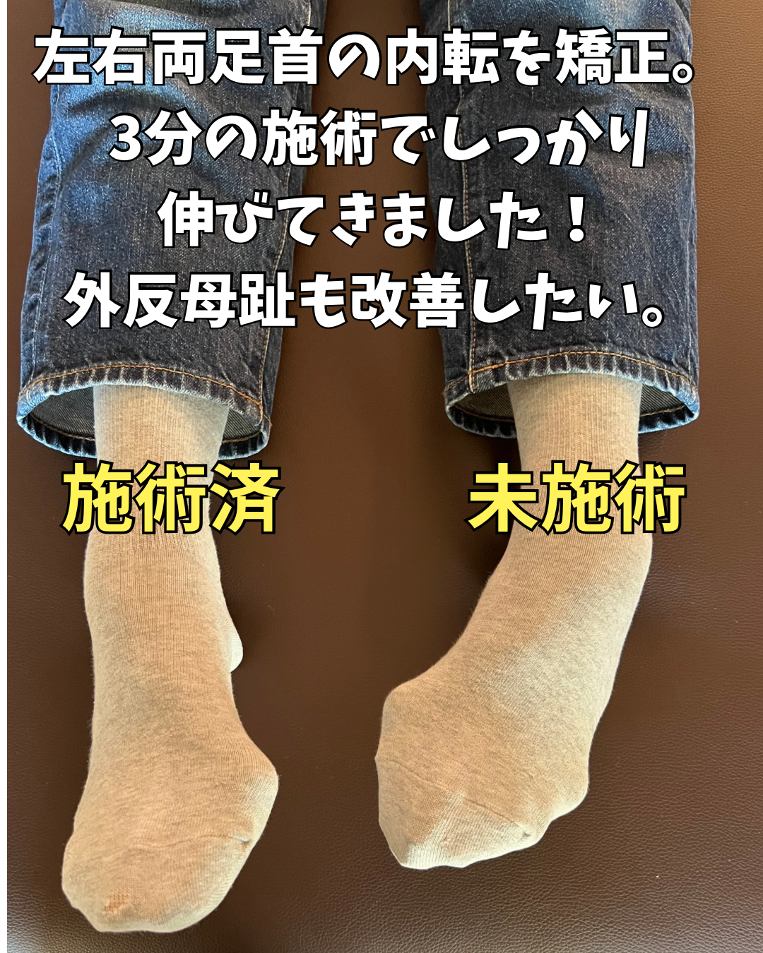 施術事例：足首の傾きを整えて、歩きやすい足元へ！【新潟市東区山の下の整体院】