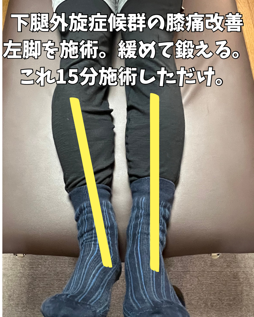 下腿外旋による膝痛が楽になった15分施術の一例【新潟市東区山の下】