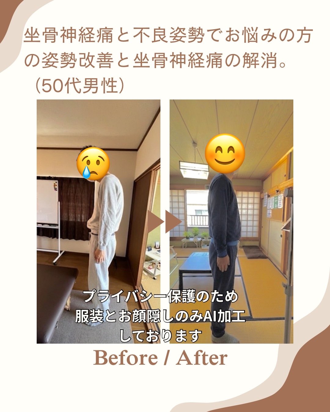 【50代男性・施術例】姿勢の崩れとつらい坐骨神経痛、4回の施術でここまで変わる！