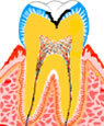 C2