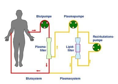 DFPP Lipidfiltration 血液净化 德国欧亚商旅