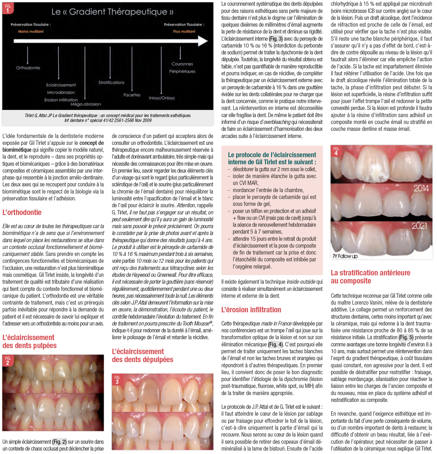 AO 49 ADF 2021 debat sur dentisterie adhesive avril 2022 - AOnews le magazine dentaire qui nous 