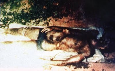 Examen interno: Después de abrir la cavidad craneal con la técnica Griessinger encontramos: cráneo intacto; edema cerebral. Además de las fotografías impactantes, el hecho de que el informe de la autopsia oficial descaradamente afirma que la víctima fue