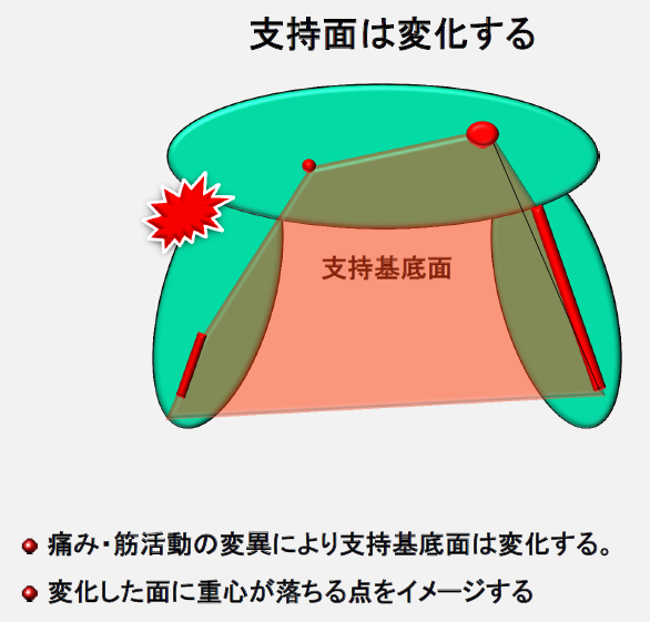 猫背や不良姿勢により重心が支持基底面より外に位置するとからだに捻れや痛みが出やすくなりまた、日常生活の立つ座る歩くに、また、スポーツでのパフォーマンス低下につながります。