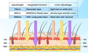 Was ist SHR Laser Haarentfernung? Was ist SHR Laser Haarentfernung?
