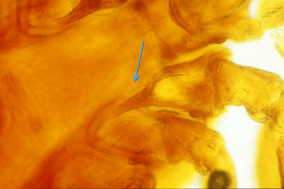Epine présente sur la première paire de pattes d’Ixodes ricinus