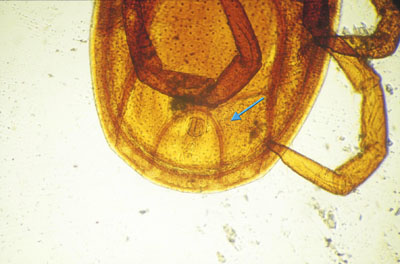 Sillon anal contournant l’anus par l’avant chez Ixodes ricinus