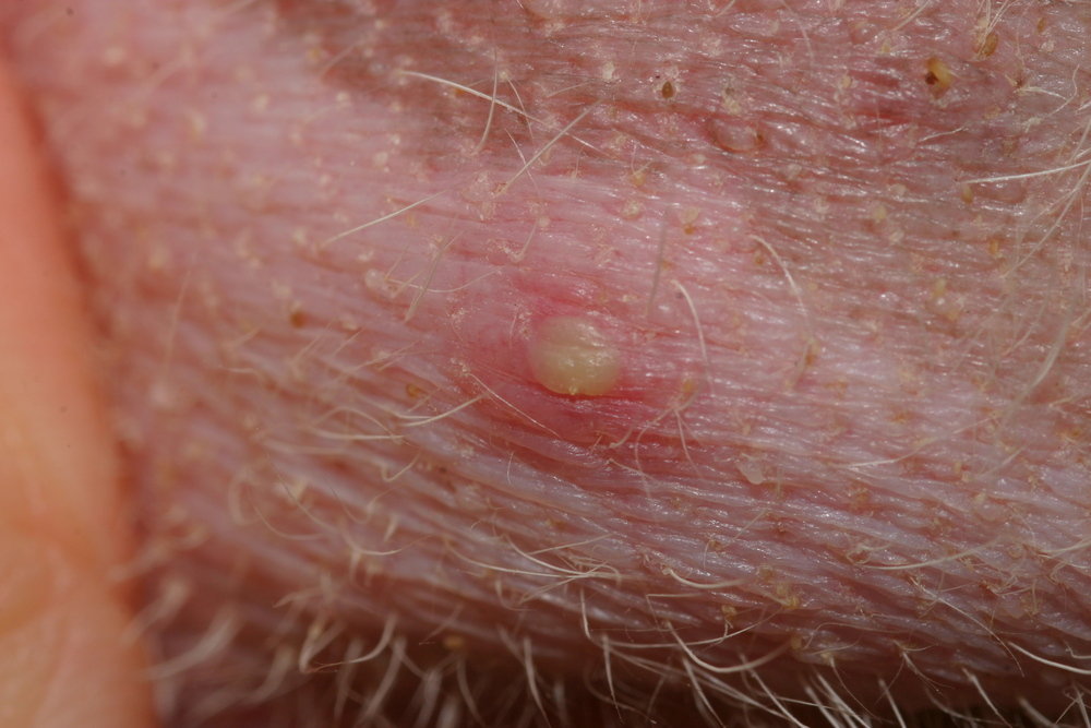 Pyodermites du chien : Causes et traitements  2026 (Photos)
