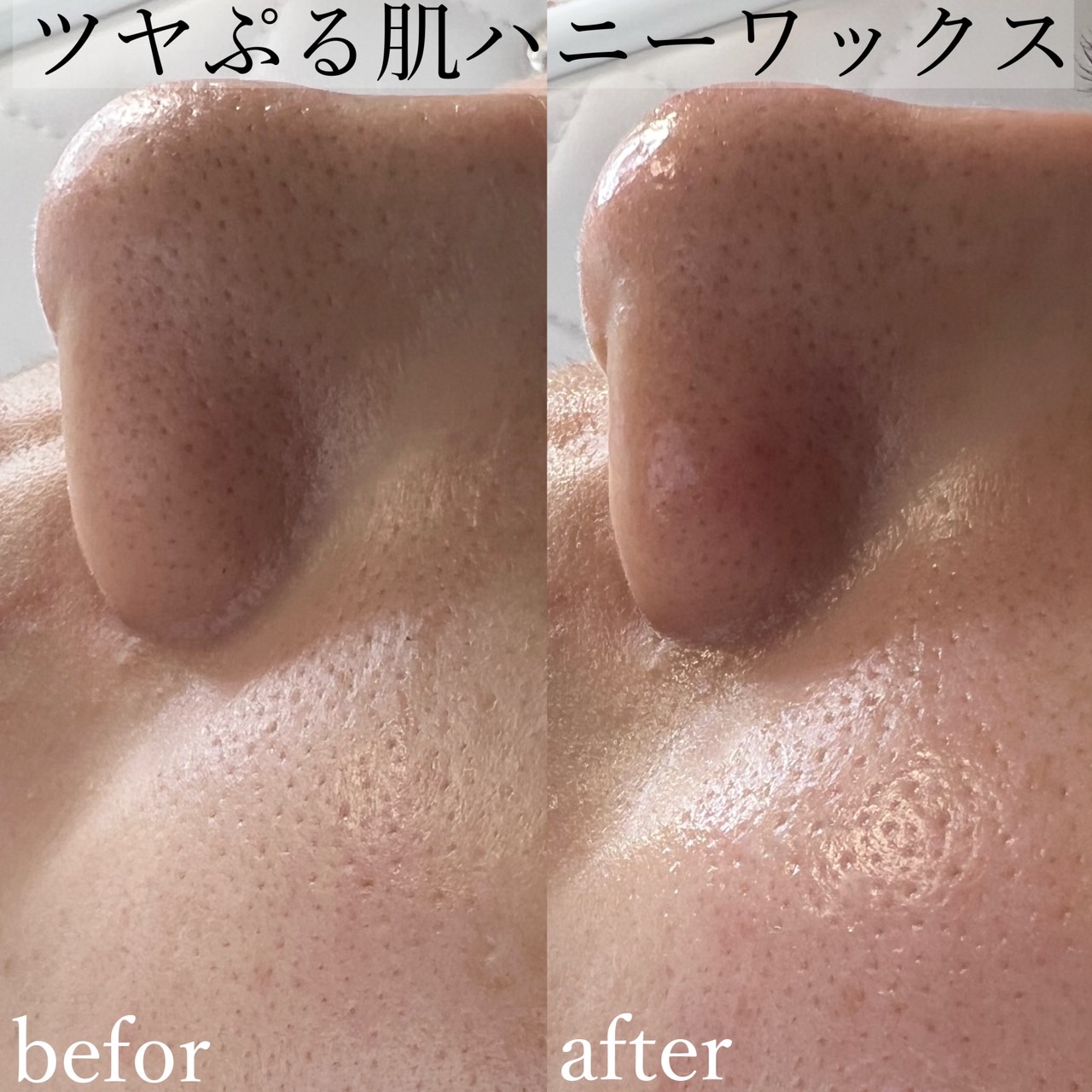 フェイシャルワックスで美肌に