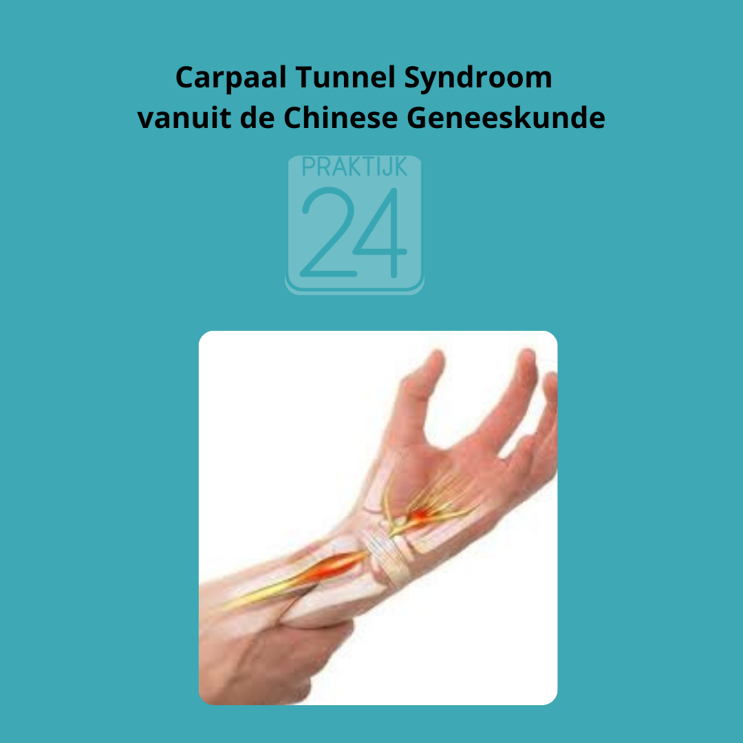 Carpaal Tunnel Syndroom