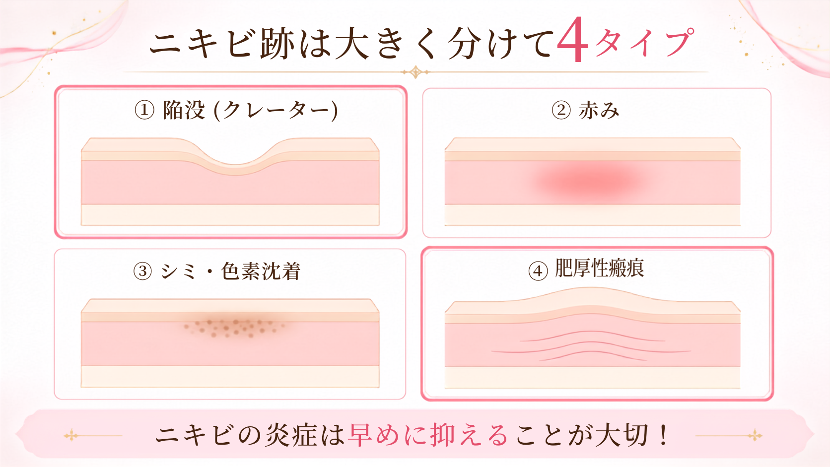 ニキビ跡は大きく分けて4タイプ｜赤み・シミ・クレーターの違い