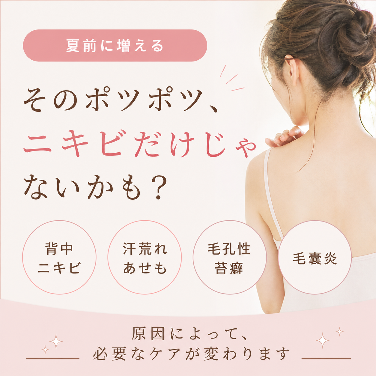 その背中のポツポツ、背中ニキビだけじゃないかも？