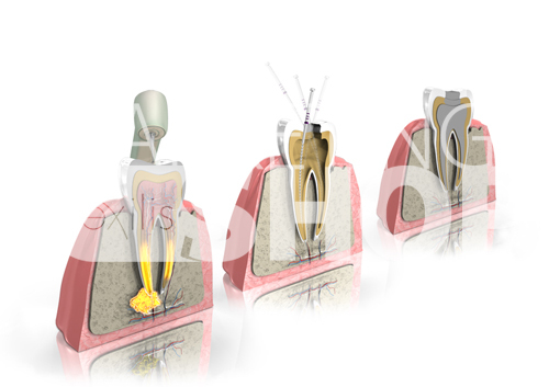 3D-Infografiken