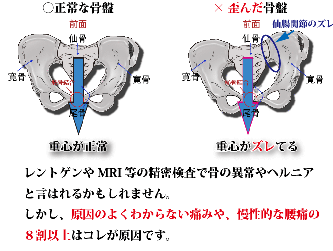 骨盤のゆがみ、ずれは気になりませんか? - 愛西・津島はぴくろ 骨盤のゆがみ、ずれは気になりませんか? - 愛西・津島はぴくろ