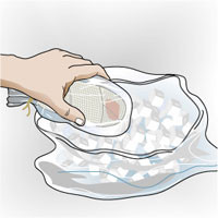 Manejo de miembro amputado