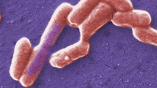 Tempi e modi delle malattie trasmesse da alimenti ...