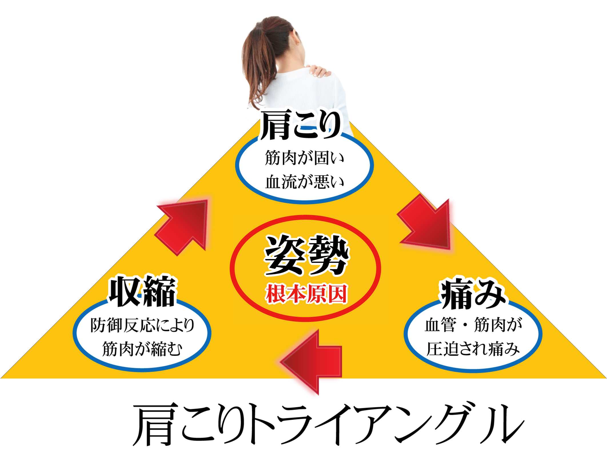 松山市で肩コリに悩む人が陥る、肩こりトライアングル!肩こりを放っておくと、筋肉血管が圧迫され痛みが出現します。それにより、身体に防御反応がおこり筋肉が縮みます。その結果、あなたの肩こりがひどくなる。松山市あい整骨院久枝では、そんな肩こりに対して専門家が施術します。肩こりトライアングルを改善しましょう。
