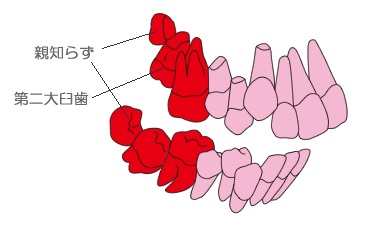 親知らずの位置のイラスト図