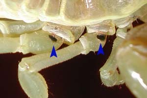 Micosis