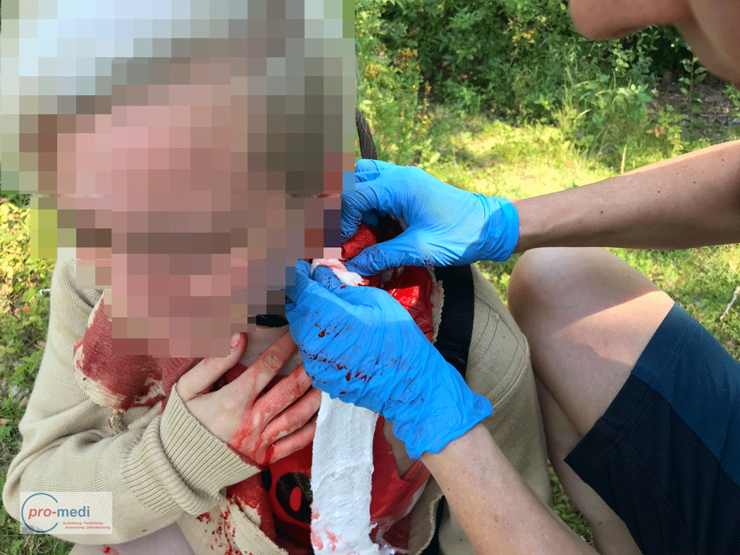 Medizinische Versorgung einer Halsverletzung