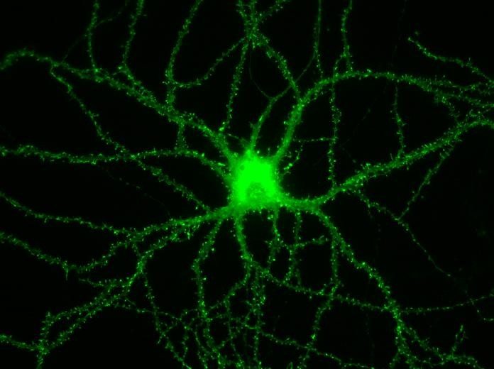Hippocampal neuron in culture transfected with an Actin-GFP vector. Photo: L. Enríquez-Barreto & G. Cuesto.