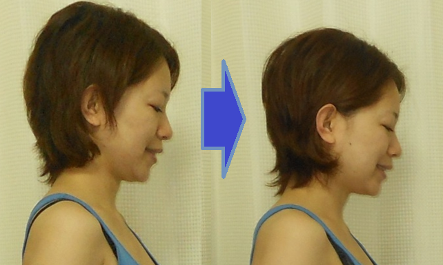 ◾️最終価格◾️はじめての人のための頭蓋骨矯正 楽天市場】頭蓋骨 矯正の通販