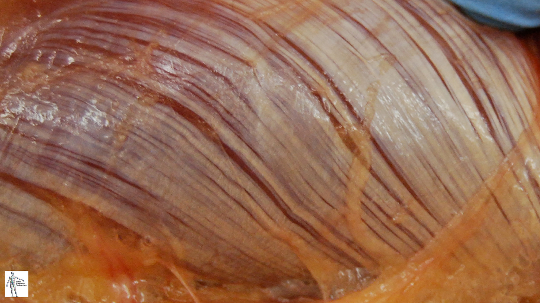 Le fascia : le trait d'union du Corps Humain! Le fascia : le trait d'union du Corps Humain!