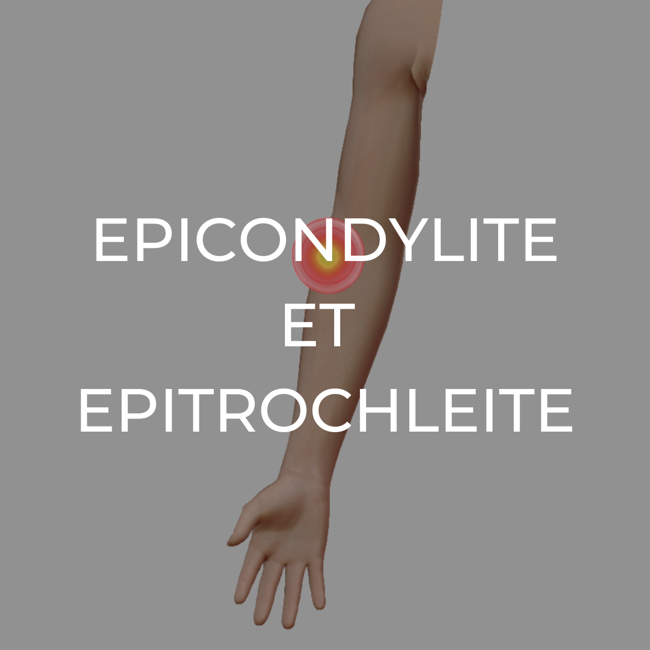 Produits recommandes en cas d'epicondylite et d'epitrochleite