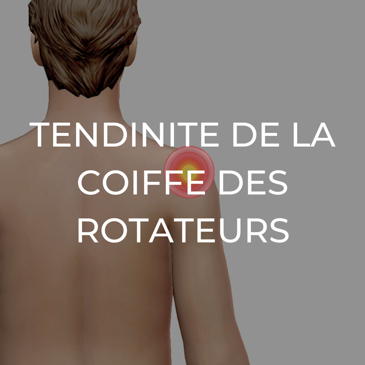 Produits recommandes en cas de tendinite de la coiffe des rotateurs