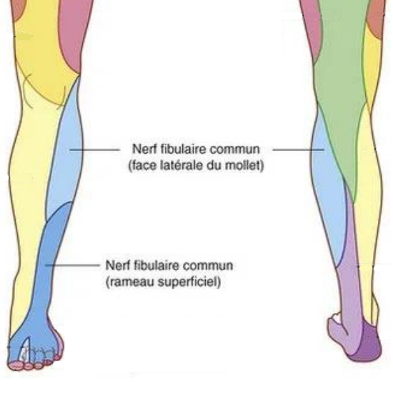 Syndrome du Nerf Sciatique Poplité Externe (SPE) Causes, Symptômes — free download