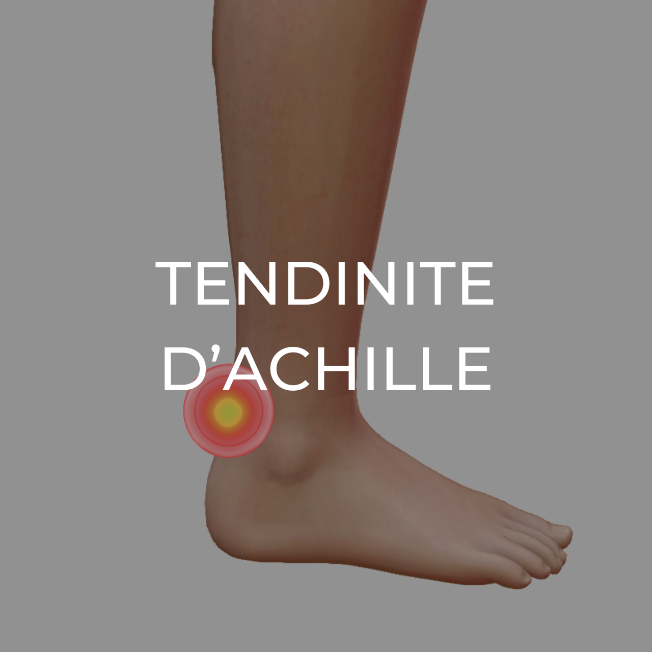 Produits recommandes en cas de tendinite d'Achille