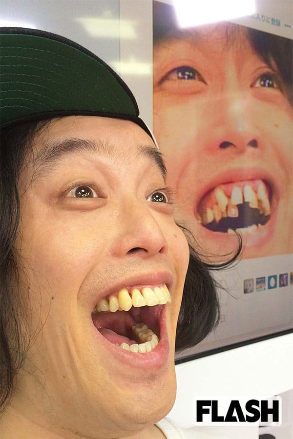 矯正治療は一生自分の歯で食事をする為に必要な治療です！
