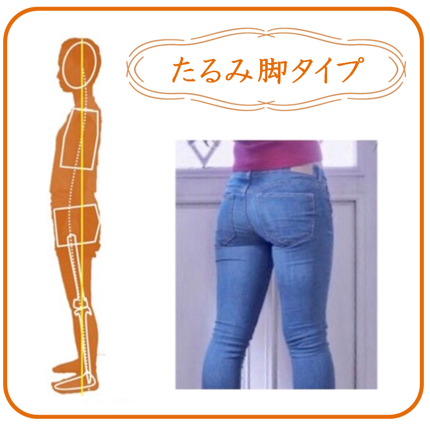 たるみ脚タイプ解消プログラム Kyakko Bijin Co Jp ページ