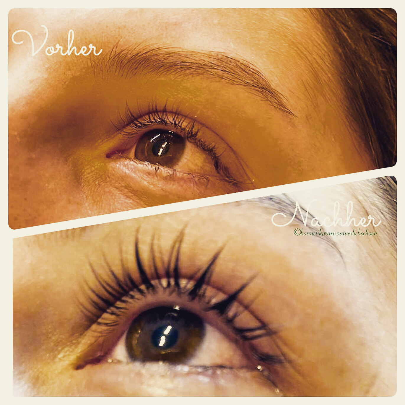 Wimpernlifting