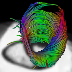 Fibres cardiaques