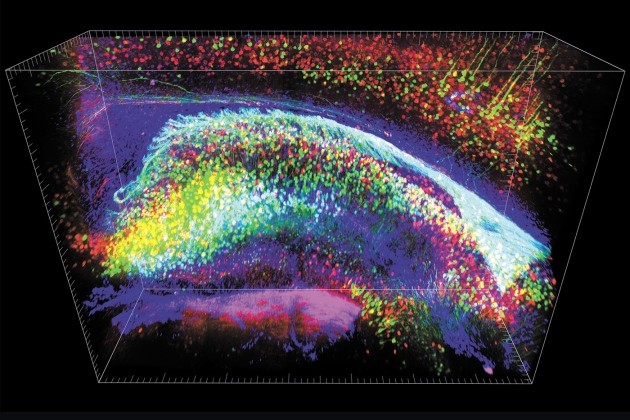 Hippocampe de souris en neuroimagerie