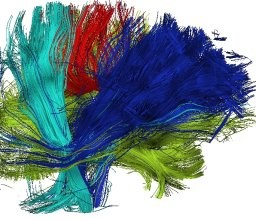 Tractographie dans des images IRM de diffusion