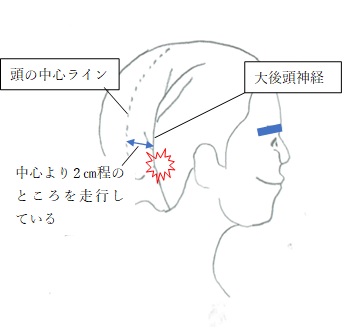 頭が痛い 後頭部が痛い 筋緊張性頭痛についてまとめ 北千住 草加 越谷 三郷 流山 松戸 柏でお悩みの方は 北千住駅近 平日22時まで 土曜祝日も19時まで診療 他とは違う そんなお声をよくいただきます 北千住 草加 越谷 三郷 流山 松戸 柏