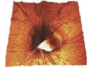 Tomographie (HRT)