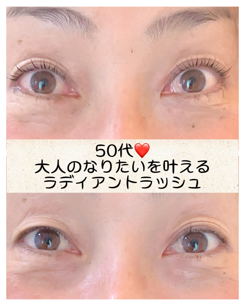 福津市まつげパーマ　アイリッドアップパーマ　アイリッドアップパーマ福岡　アイリッドアップパーマ福津