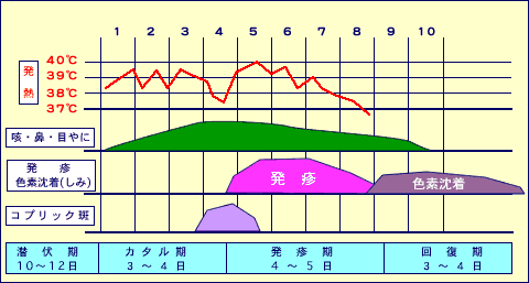 はしかの症状