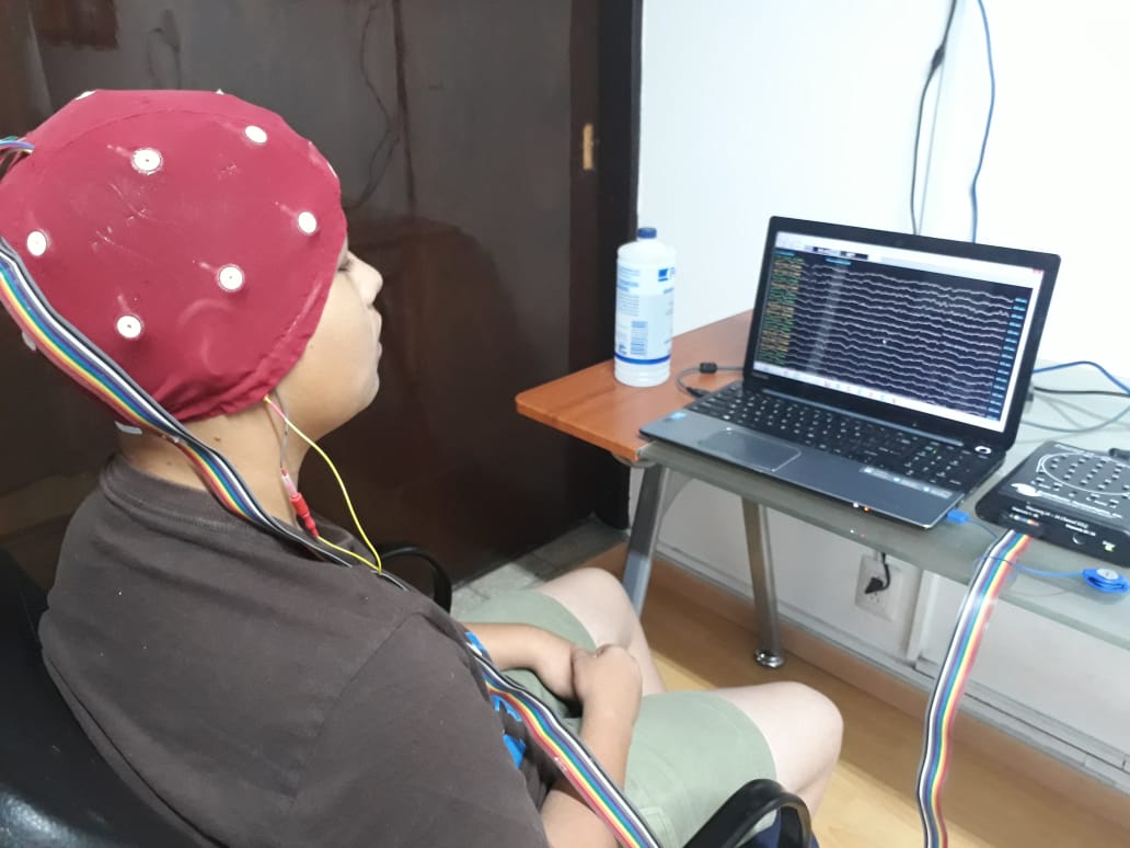 Fig. 3. Se muestra la gorra que utilizamos para realizar el mapeo cerebral. Cada uno de los botones blancos es un punto de la cabeza en donde se hace el registro de la AEC. Al fondo se observa un equipo para realzar el mapeo.