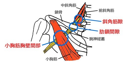 腕や手のシビレの原因