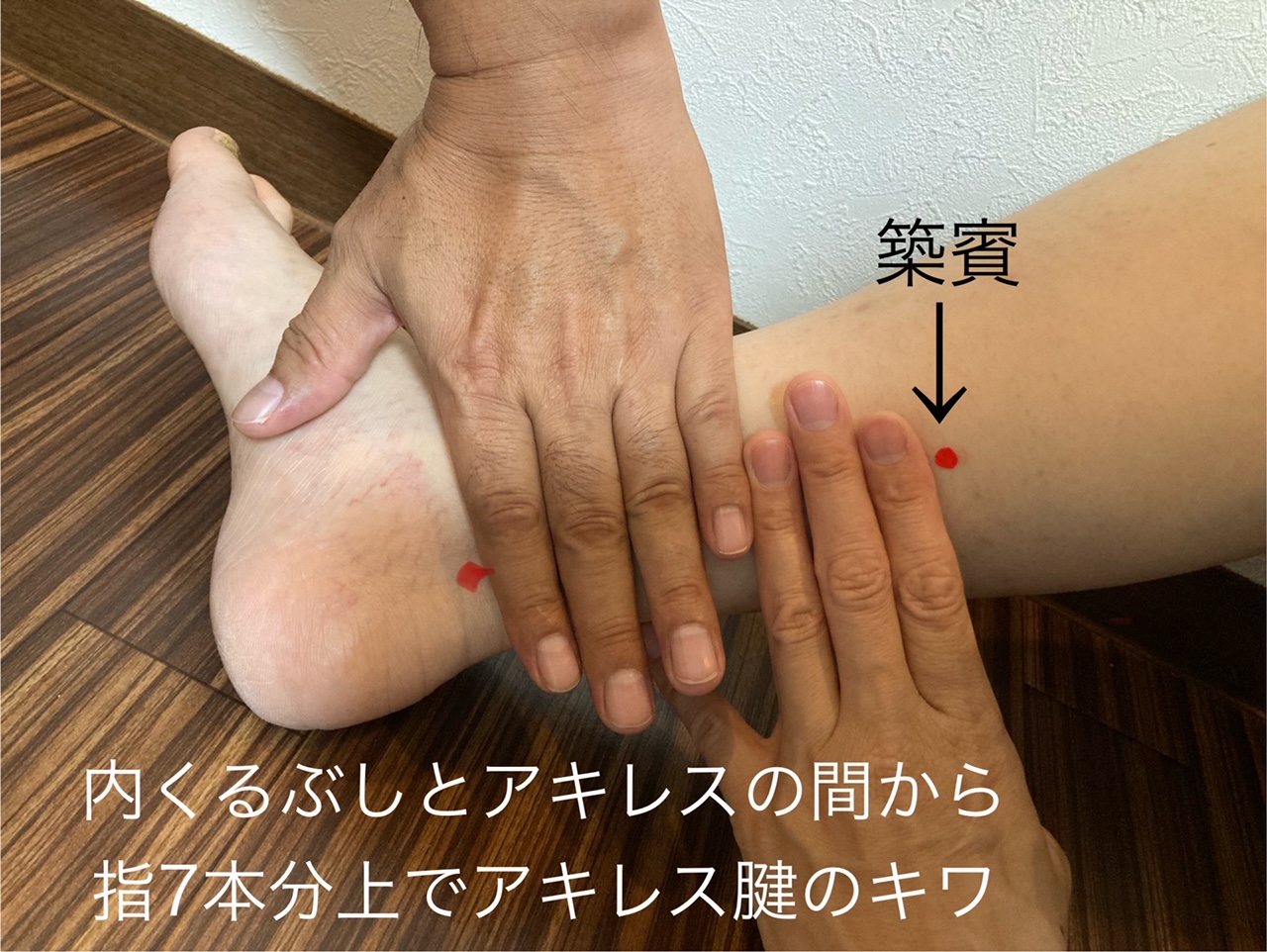 最近よく使うツボ「築賓（ちくひん）」